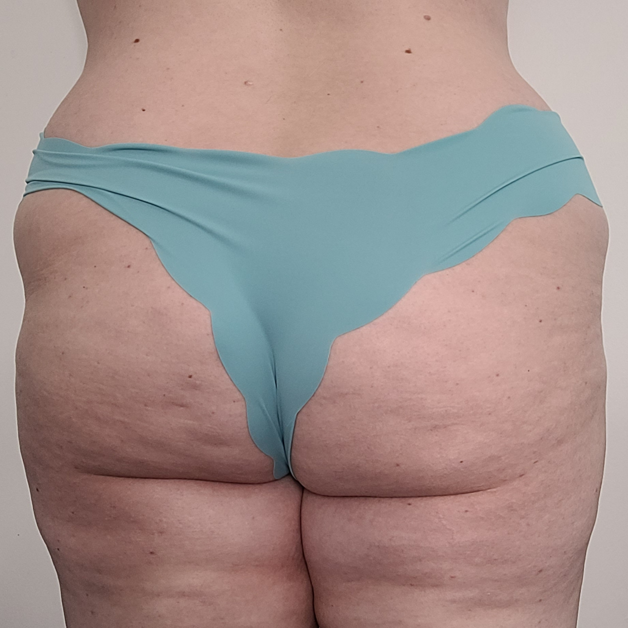 Blue Scalloped Cheeky Panties